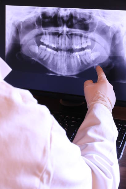 Best Emergency Dental Care for Trauma or Injury in Acton, CA