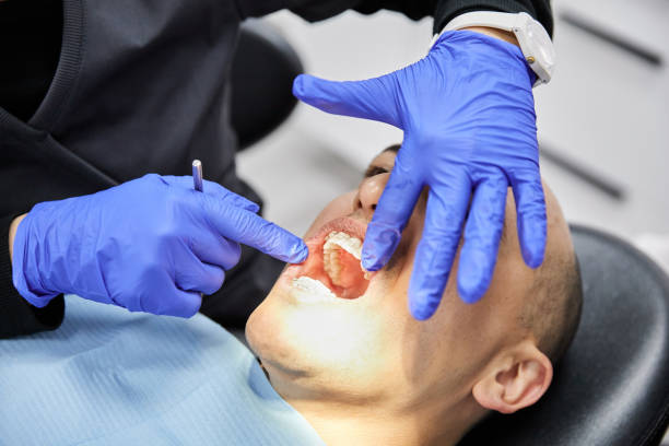 Best Emergency Wisdom Teeth Removal in Acton, CA