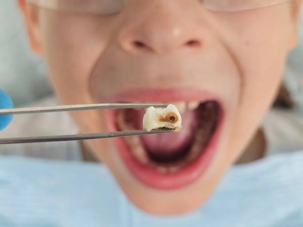 Best Same-Day Emergency Dentist in Acton, CA